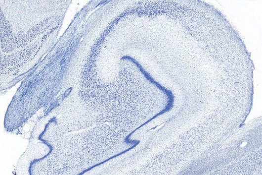 Picture 6 of Close-up of the human brain is 'sliced' newly announced