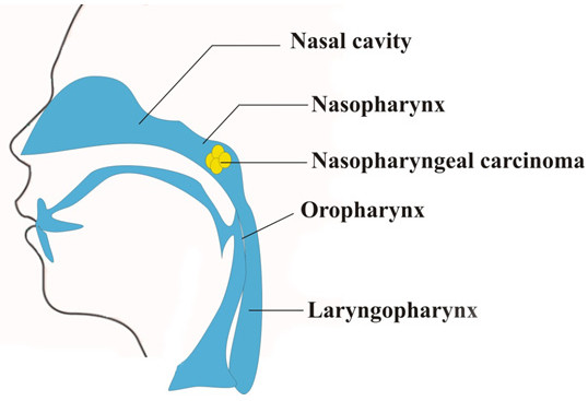 Common cancers in men