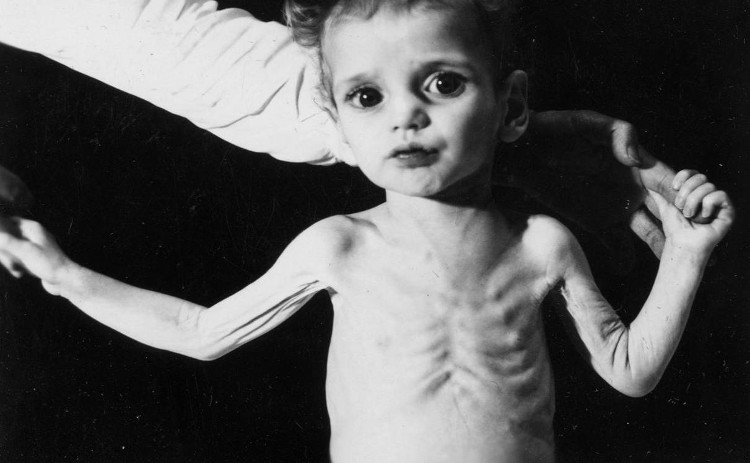 Picture 1 of Common diseases of lead poisoning