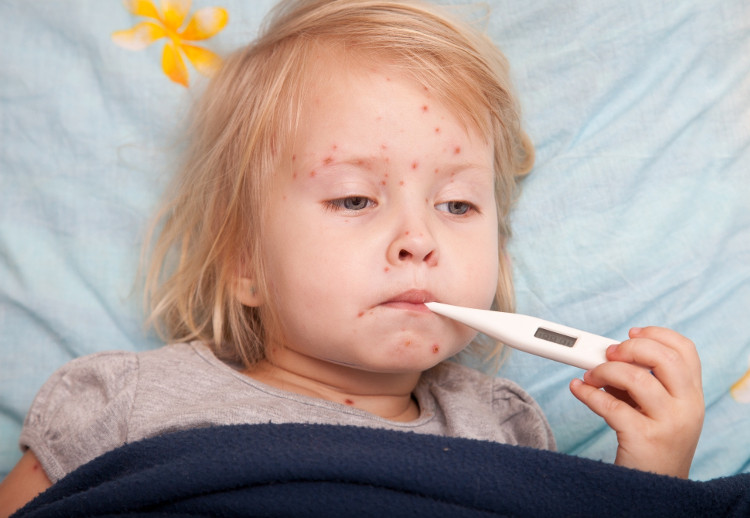 Picture 3 of Common epidemics of summer diseases