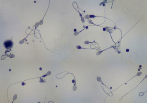 Picture 1 of Complete decoding the human sperm genome