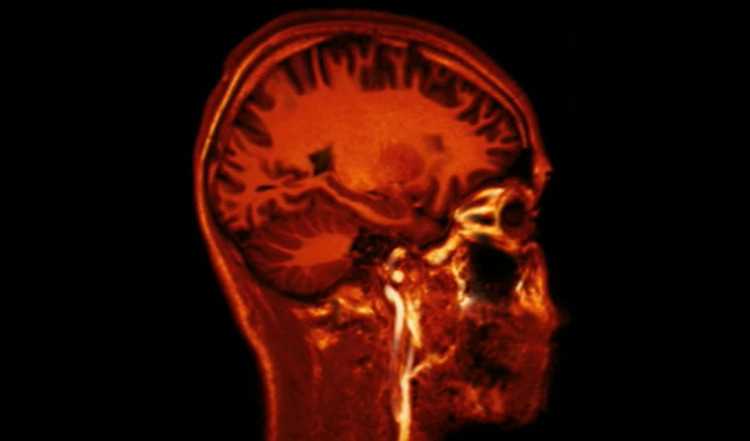 Picture 2 of Completely false thoughts about eating, sleeping, resting (part 2)