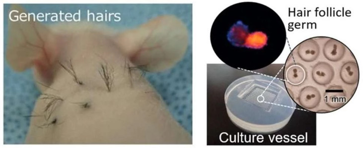 Picture 2 of Concussion detection: Potato chips can cure baldness