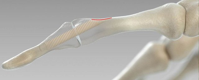 Picture 1 of Connect the bones of the screw made from ... human bones