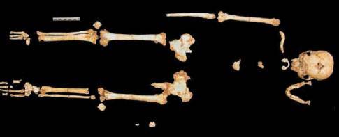 Picture 2 of Continued controversy over Flores dwarf