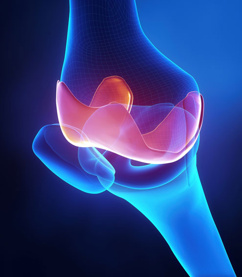 Picture 2 of Control joint pain when changing seasons
