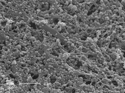 Picture 6 of Control the level of development of tissues and blood vessels instead