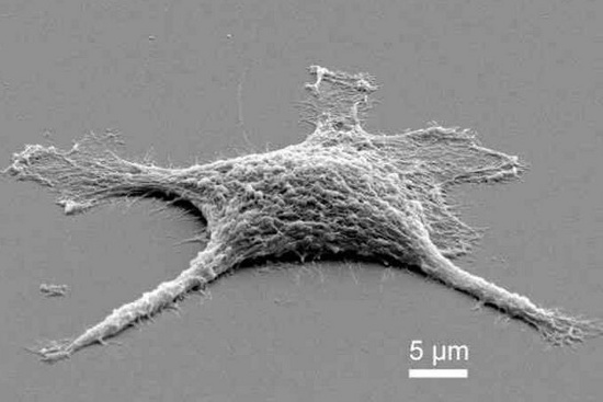 Picture 1 of Create living corpse cells