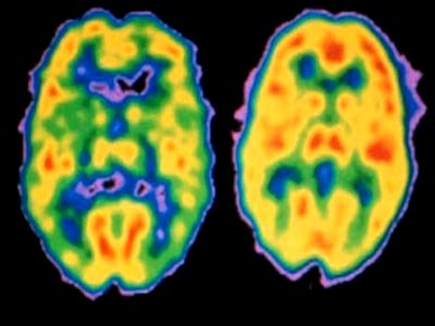 Picture 2 of Create mice with mental illness to test drugs