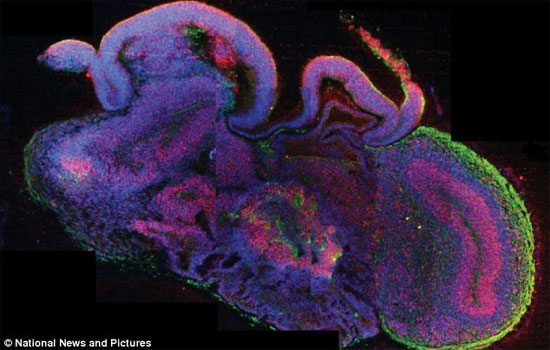 Picture 1 of Create tiny brain from human skin