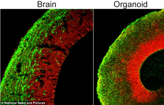 Picture 2 of Create tiny brain from human skin