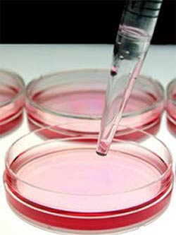 Picture 1 of Create vagina from stem cells
