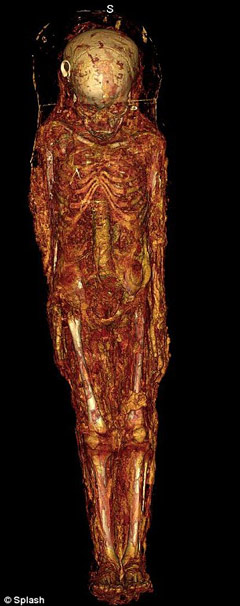 Picture 5 of CT scan to find the sex of the mummy