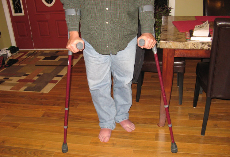 Picture 1 of Cuba found new therapies to treat many sclerosis