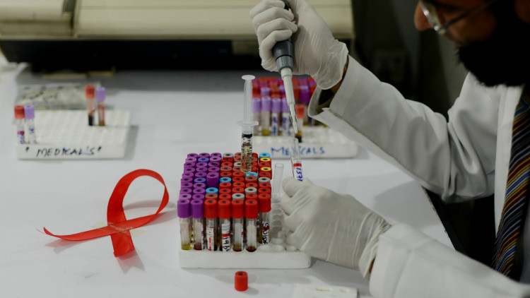 Picture 1 of Cuban researchers tested the HIV / AIDS vaccine