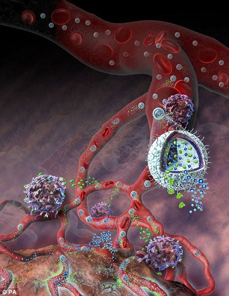 Picture 1 of Cure cancer with ... smart bomb