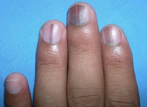 Picture 4 of Dangerous signs of the body