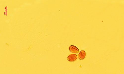 Picture 2 of Dead bugs stuck in 99 million years of amber and pollen