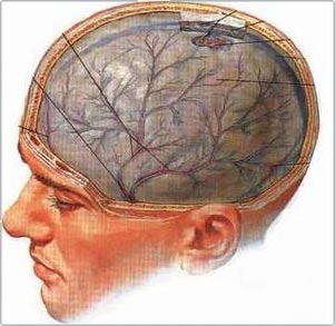 Picture 1 of Debate about the death of the brain and moral consequences