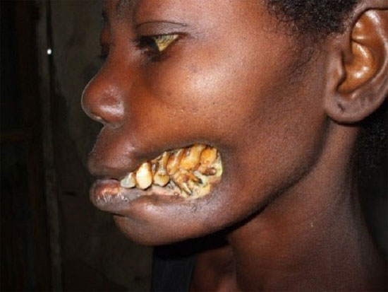 Picture 2 of Decipher the 'hard to say' diseases of people
