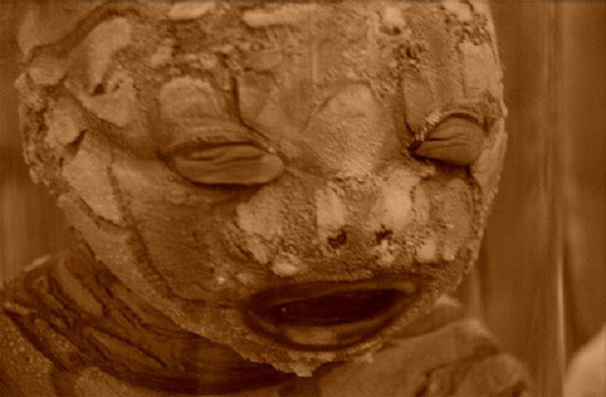 Picture 4 of Decipher the 'hard to say' diseases of people