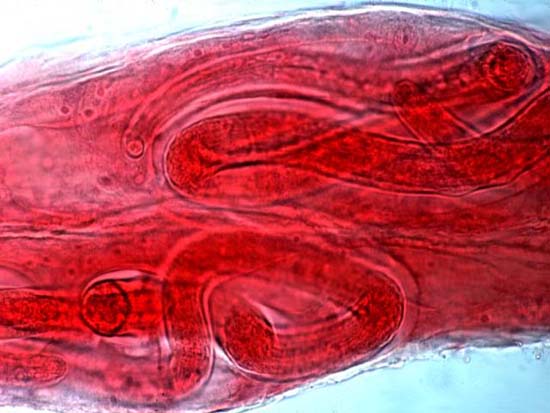 Picture 1 of Decode helminth genes