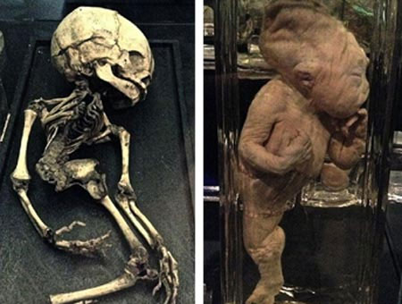 Picture 2 of Decode the mermaid phenomenon in real life