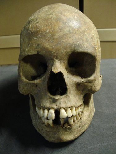 Picture 3 of Decoding the gene that causes the Black Death