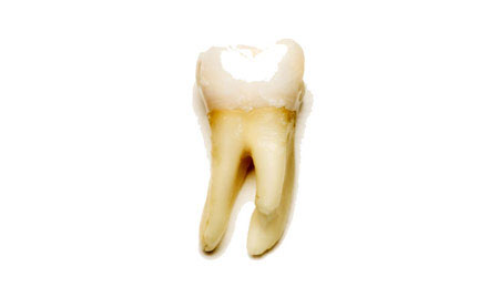 Picture 1 of Deep tooth itself