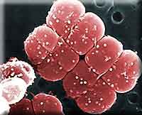 Deinococcus radiodurans, the only organism to withstand high radiation images 1