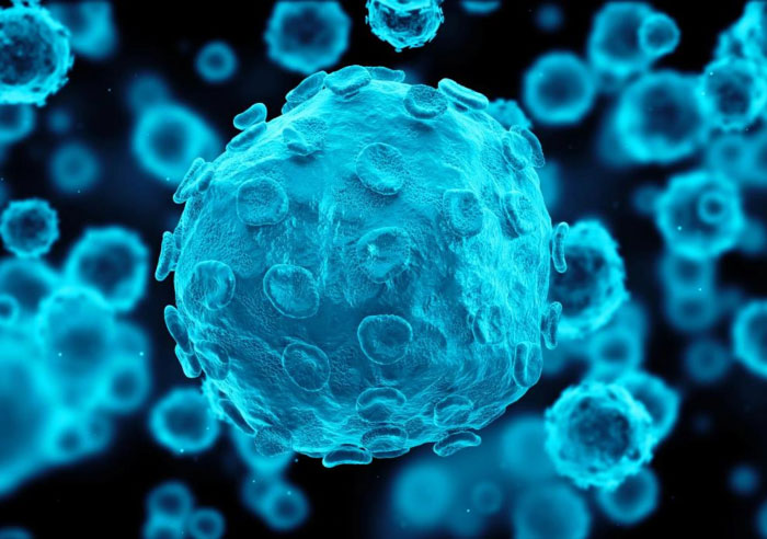 Picture 1 of Dementia because ... ever sexually infected?