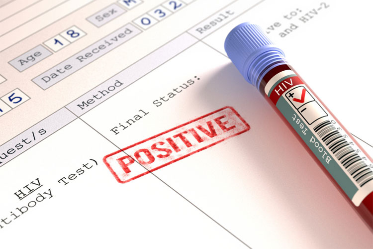 Picture 2 of Denmark may be the first country to fully cure the HIV virus