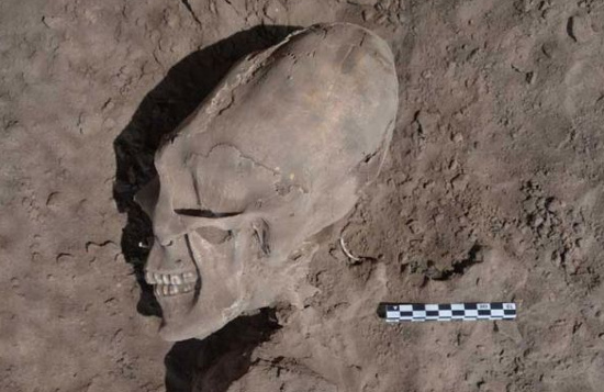 Picture 1 of Detect strange skull