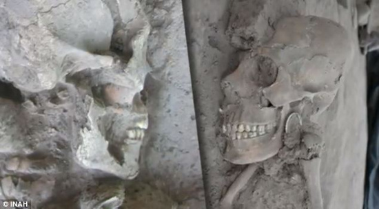 Picture 2 of Detect strange skull