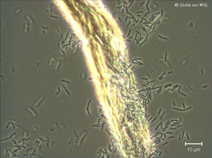 Picture 1 of Detecting a bacterium that eats CO2