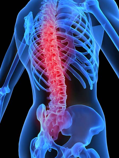 Picture 1 of Detecting a mutant gene causes bone disorder