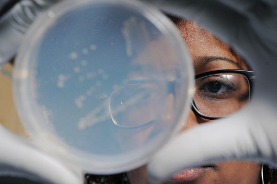 Picture 1 of Detecting a significant amount of microorganisms in the troposphere