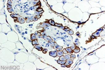 Detecting cancer antigens with nano holes images 3