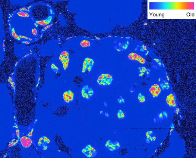 Picture 1 of Detecting cells with age equal to the age of the body