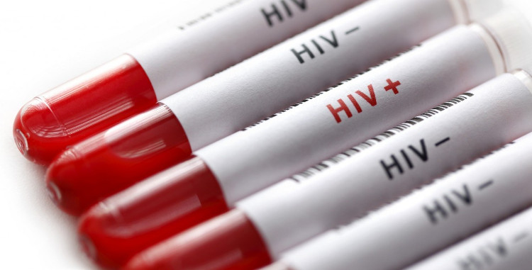 Picture 1 of Detecting drugs that treat lung cancer can kill HIV cells
