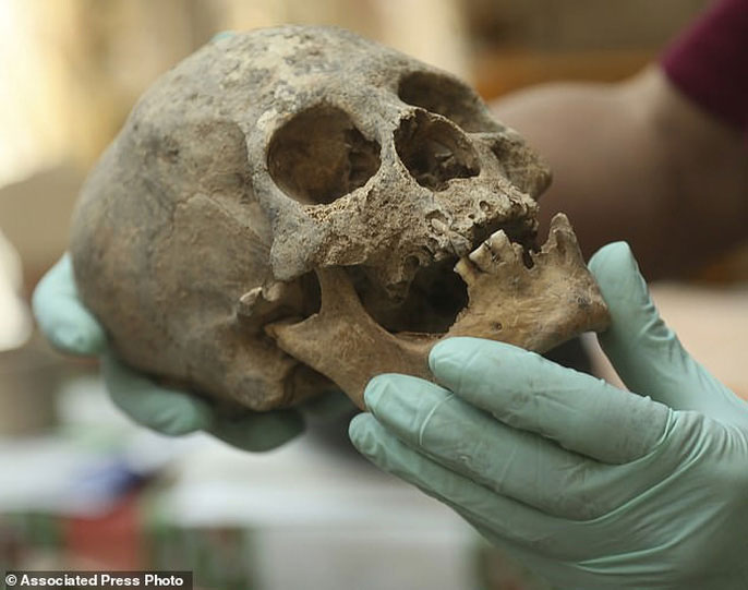 Picture 6 of Detecting more than 100 deformed remains in stone quarries