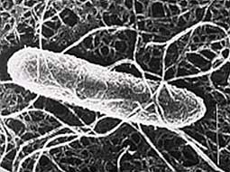 Detecting new toxins of bacteria in the gastrointestinal tract images 1