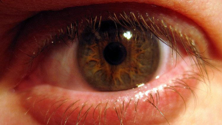 Picture 3 of Detecting shock: In the eyes of 1 microbial community exists