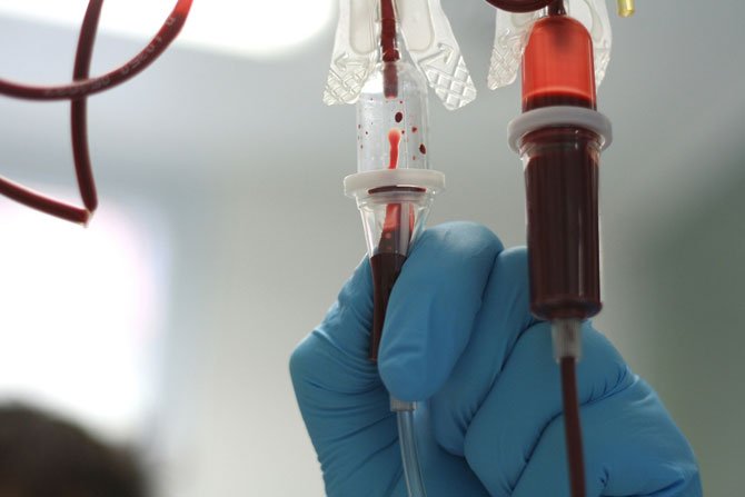 Picture 1 of Detecting the 'brother' virus strain of hepatitis C virus