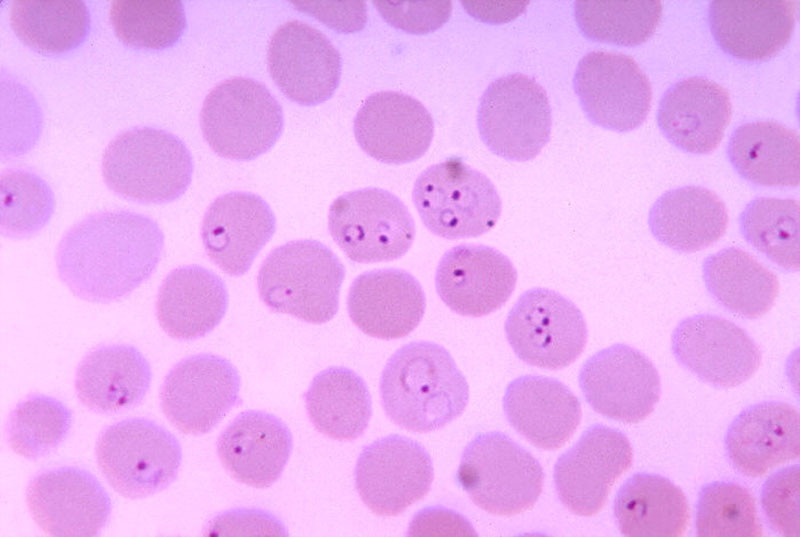 Picture 1 of Detecting the path of infection of malaria