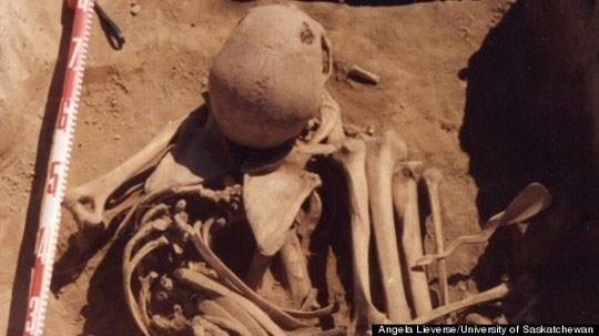 Picture 1 of Detecting the remains of cancer patients 4,500 years ago