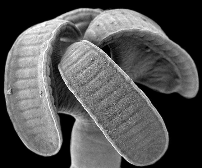 Picture 2 of Detecting the tapeworm species longer (0.3m)