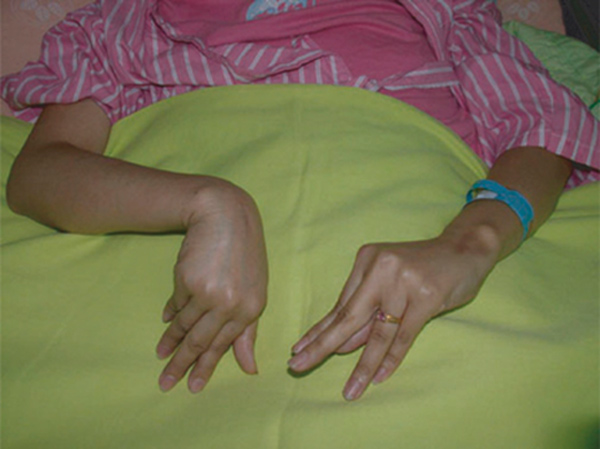 Picture 2 of Detection and treatment of hypocalcaemia