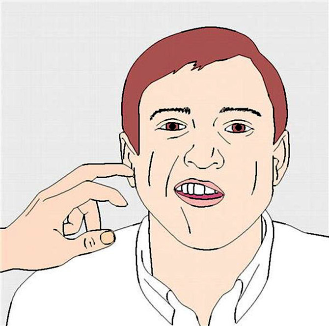Picture 3 of Detection and treatment of hypocalcaemia