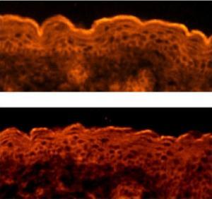 Picture 1 of Detection of genes that control skin formation